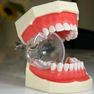 Prop Safe (Anterior and Posterior)